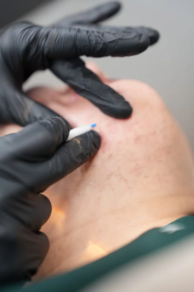 Insertion du filament en gros plan, geste de précision — B Skin Legacy